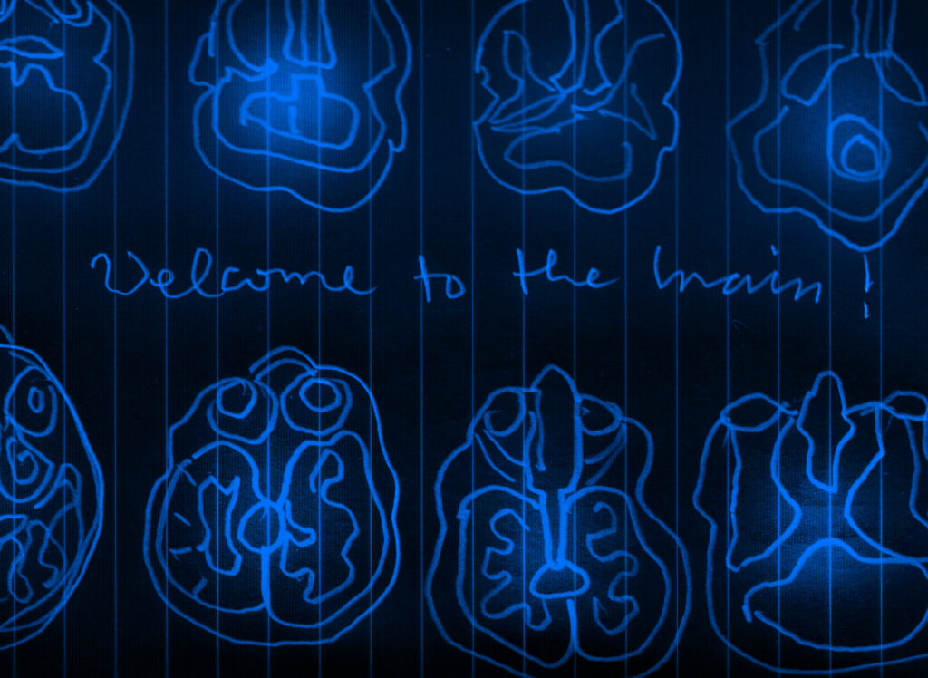 Zeichung von einem horizontal aufgeschnittenen Gehirn. Darstellung als Blaupause. Als Handschrift dazwischen: "Welcome to the brain!"